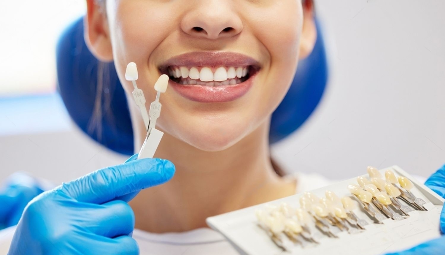 https://www.tooth-tastic.com/wp-content/uploads/2024/08/2-Replacing-Old-Veneers-per-tooth.jpeg