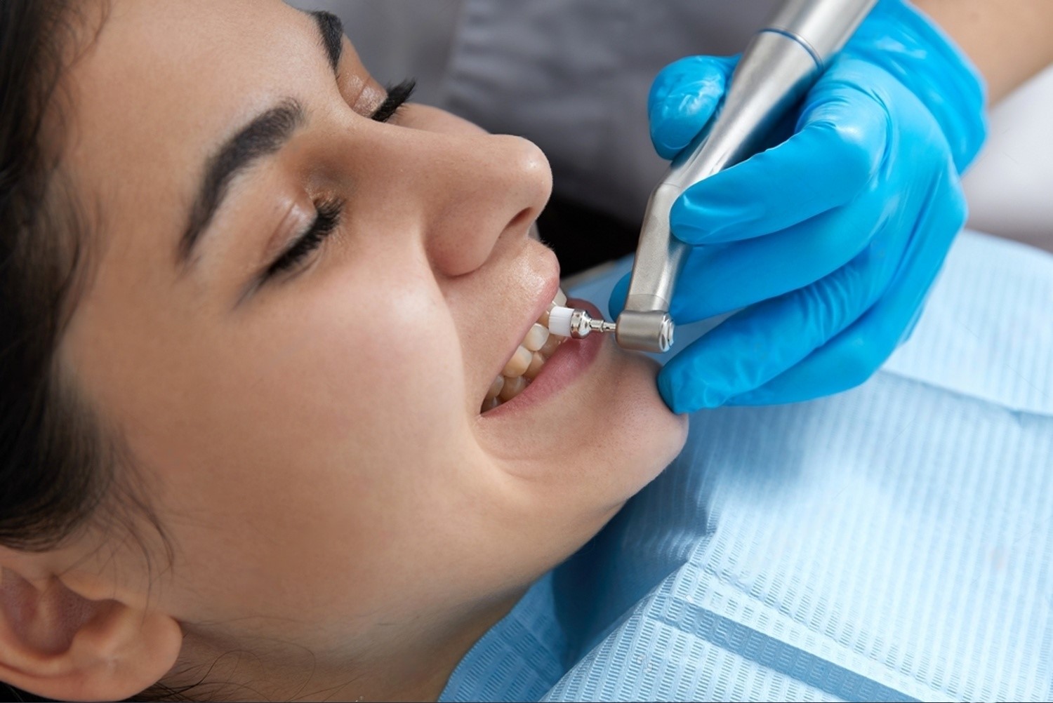 https://www.tooth-tastic.com/wp-content/uploads/2024/08/3-Scaling-and-Polishing.jpeg