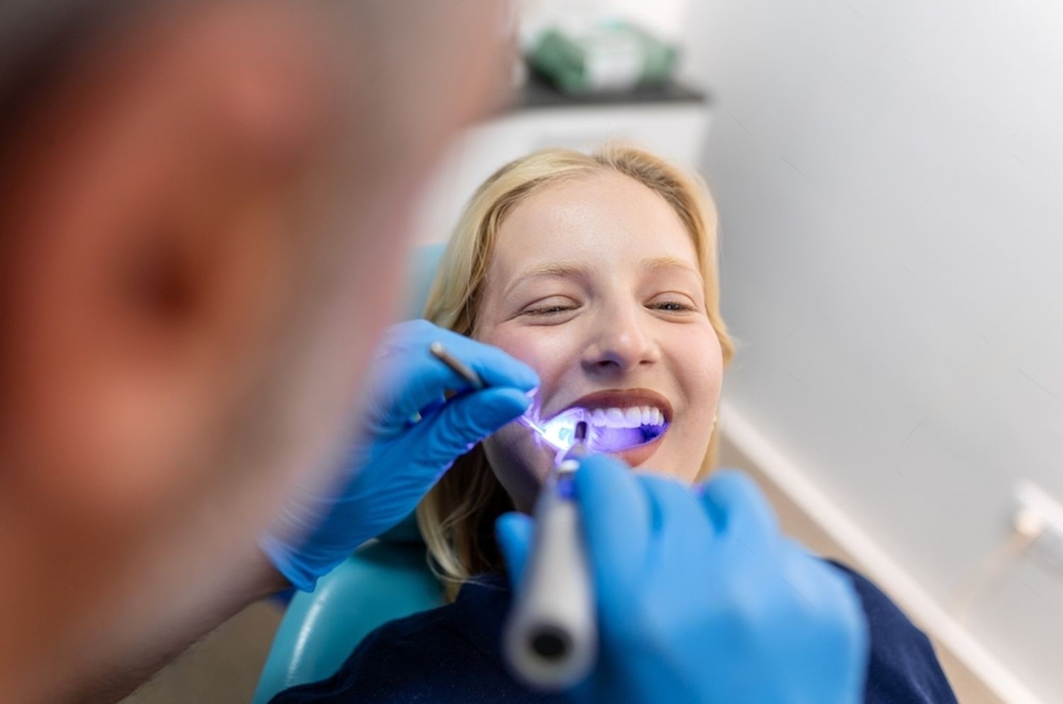 https://www.tooth-tastic.com/wp-content/uploads/2024/08/9-Composite-Dental-Filling.jpeg